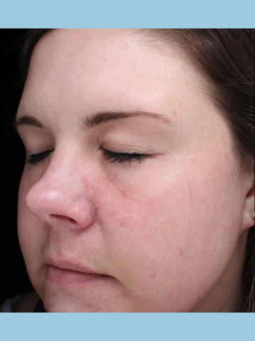 Case # 16 after photo