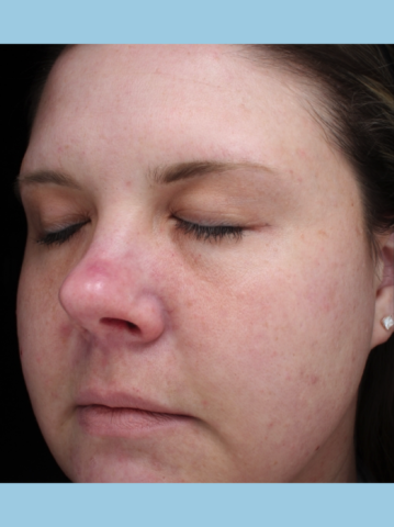 Case # 16 before photo