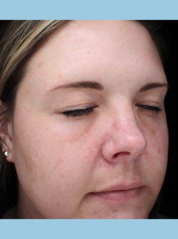 Case # 16 after photo