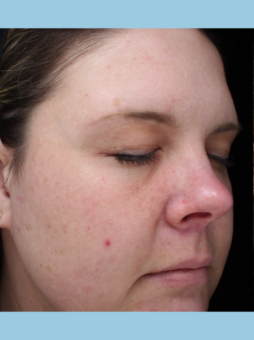 Case # 16 before photo