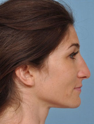 Case # 5 before photo