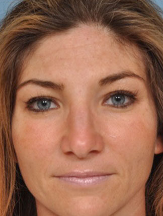 Case # 5 after photo