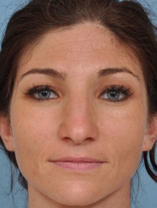 Case # 5 before photo