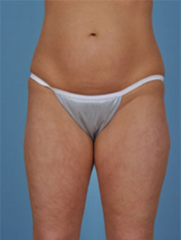 Case # 2 before photo