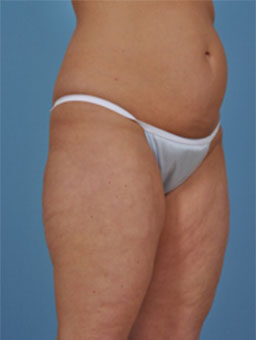 Case # 2 before photo