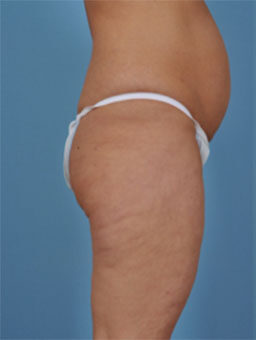 Case # 2 before photo