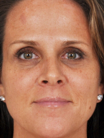 Case # 10 before photo