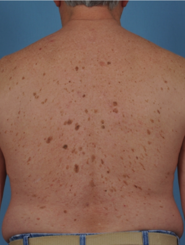 Case # 5 before photo