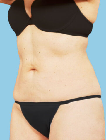 Case # 8 after photo