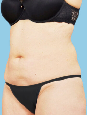 Case # 8 before photo