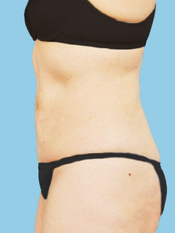 Case # 8 after photo