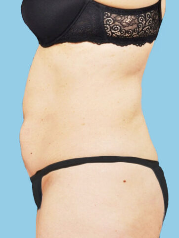 Case # 8 before photo