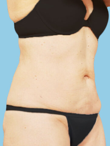 Case # 8 after photo