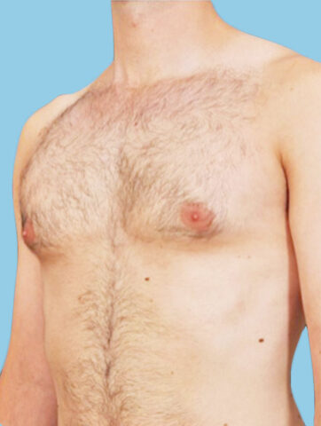 Case # 14 after photo