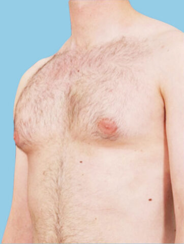 Case # 14 before photo