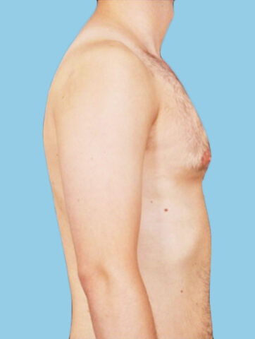 Case # 14 after photo