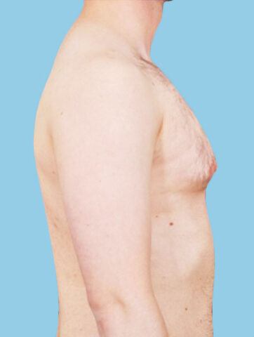 Case # 14 before photo