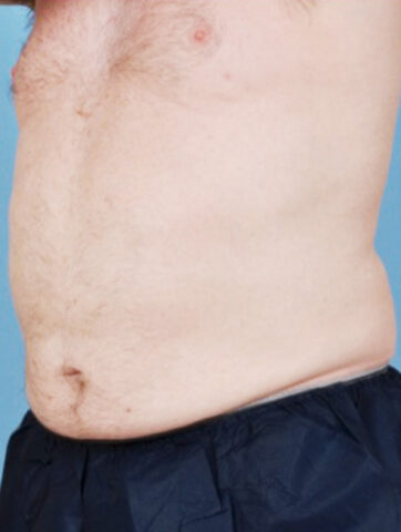 Case # 7 after photo