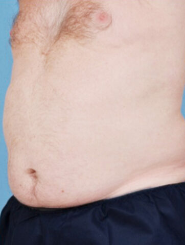 Case # 7 before photo