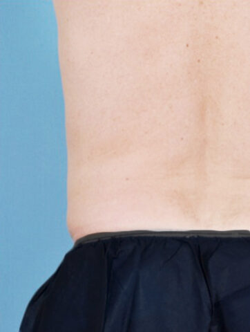 Case # 7 after photo