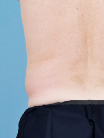 Case # 7 before photo