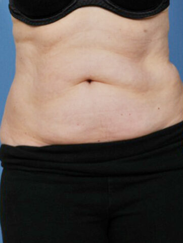 Case # 21 before photo