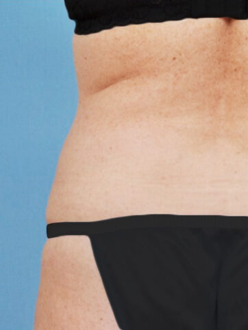 Case # 22 after photo