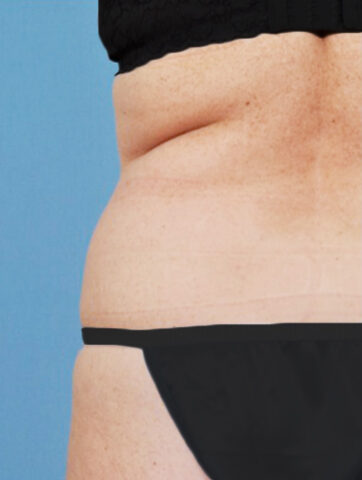 Case # 22 before photo