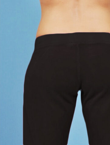 Case # 23 after photo