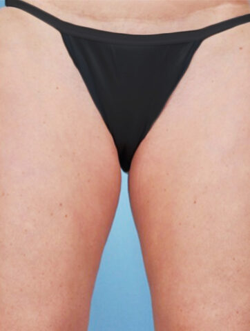 Case # 19 before photo