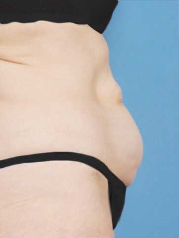 Case # 15 before photo