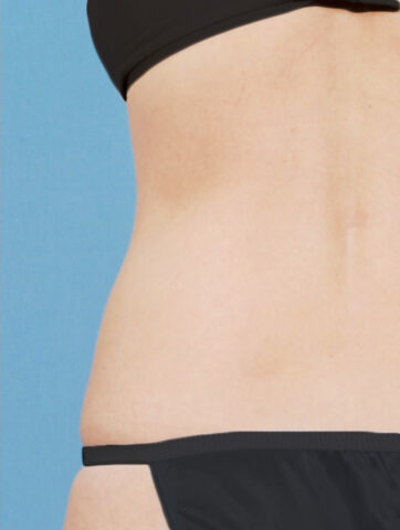 Case # 18 after photo