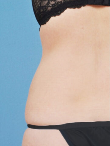 Case # 18 before photo