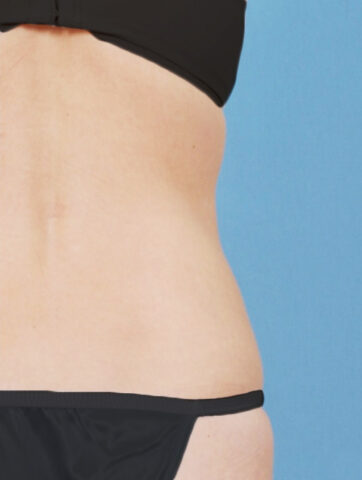 Case # 18 after photo