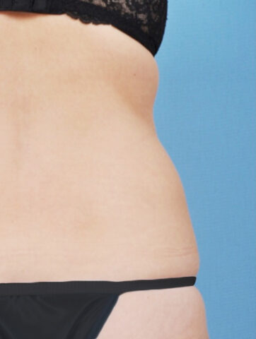 Case # 18 before photo