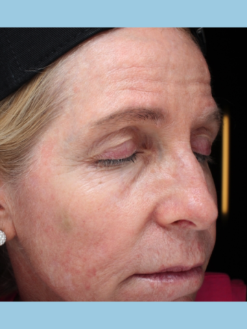 Case # 15 after photo