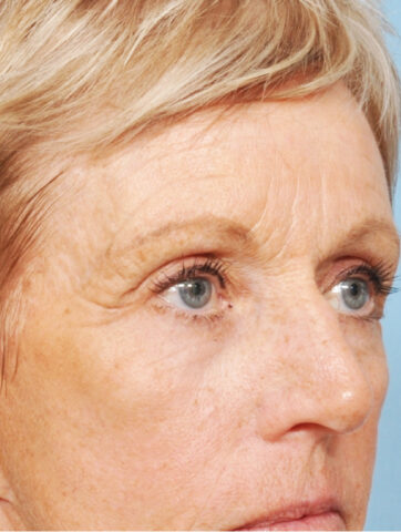 Case # 11 before photo