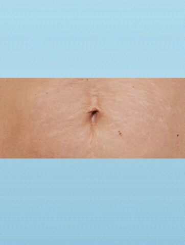 Case # 7 after photo