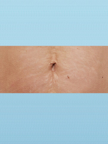 Case # 7 before photo