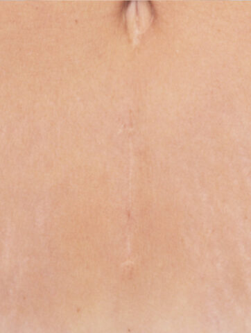 Case # 6 after photo