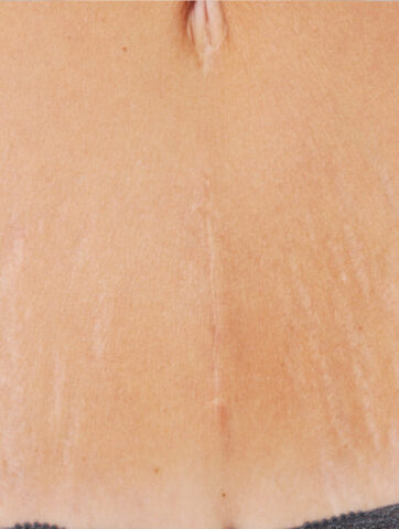 Case # 6 before photo