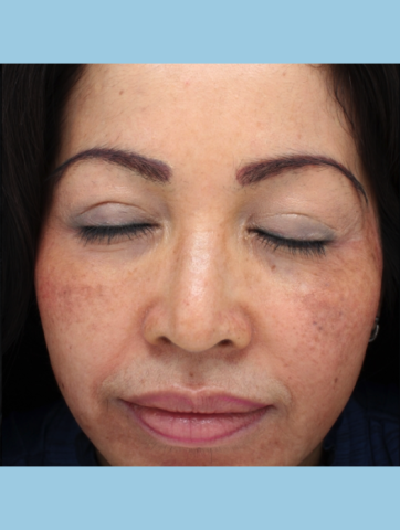 Case # 2 after photo