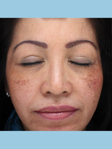 Case # 2 before photo