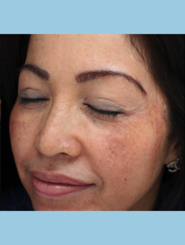 Case # 2 after photo