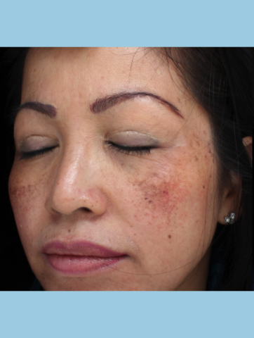 Case # 2 before photo