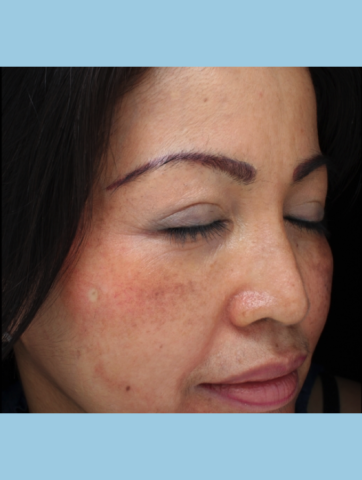 Case # 2 after photo