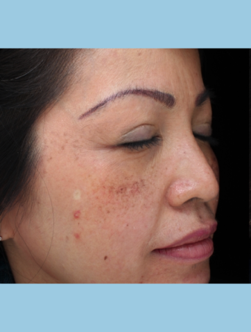 Case # 2 before photo