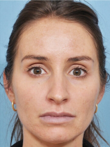 Case # 1 after photo