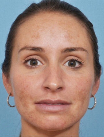 Case # 1 before photo