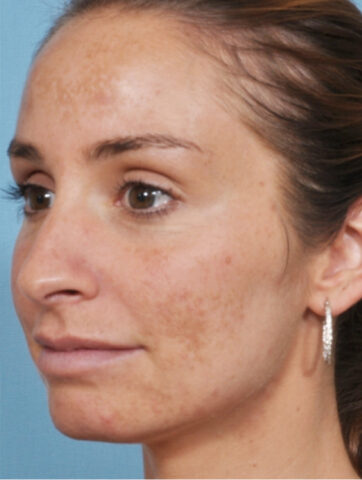 Case # 1 before photo